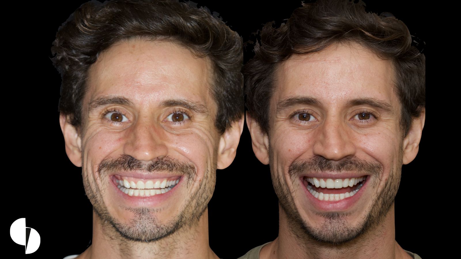 Resultado Dental Concept 2